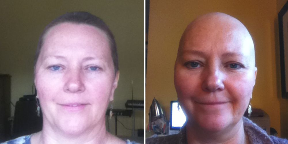 Chrystel Mann before and after cancer treatment