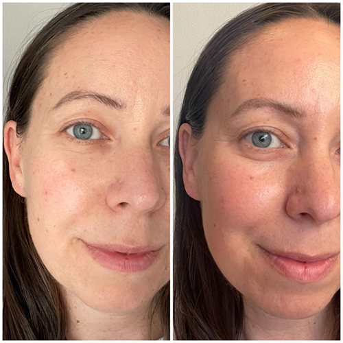 Alyssa before and after using gemstone collection