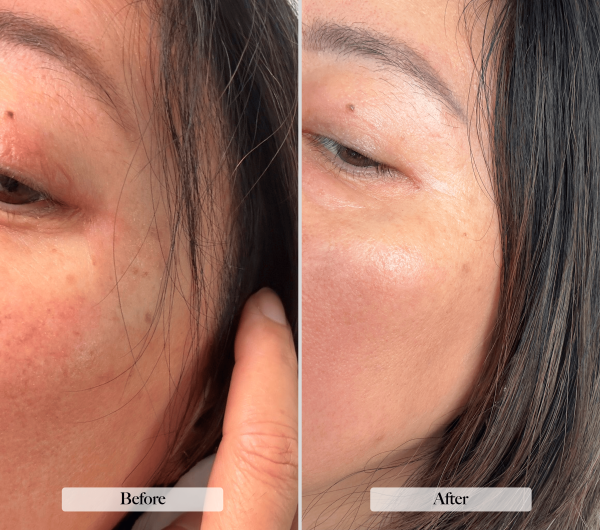 christin's before and after photo