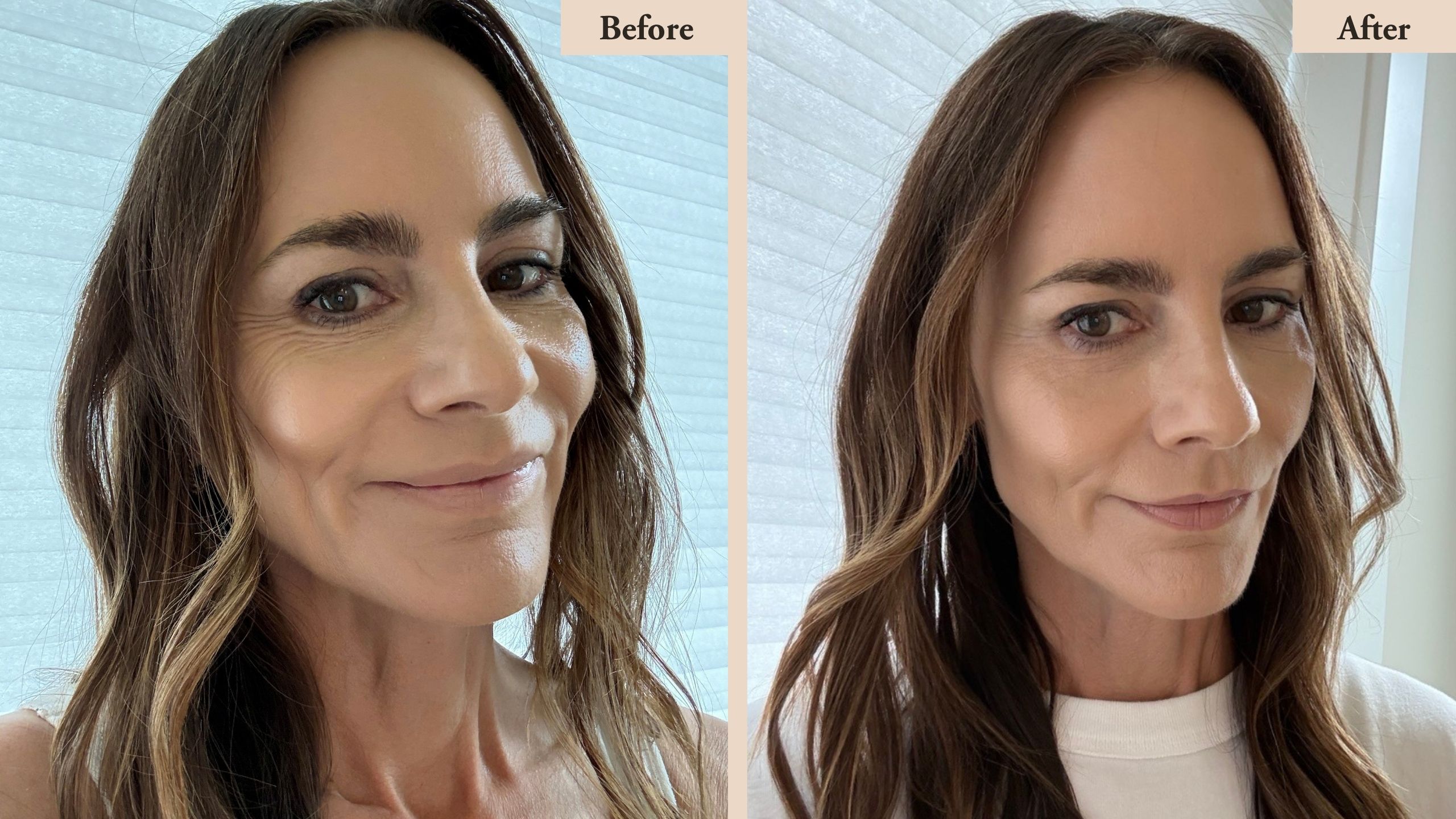 before and after photos dehydration lines