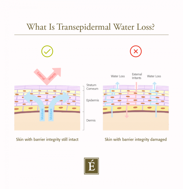What is transepidermal water loss infographic