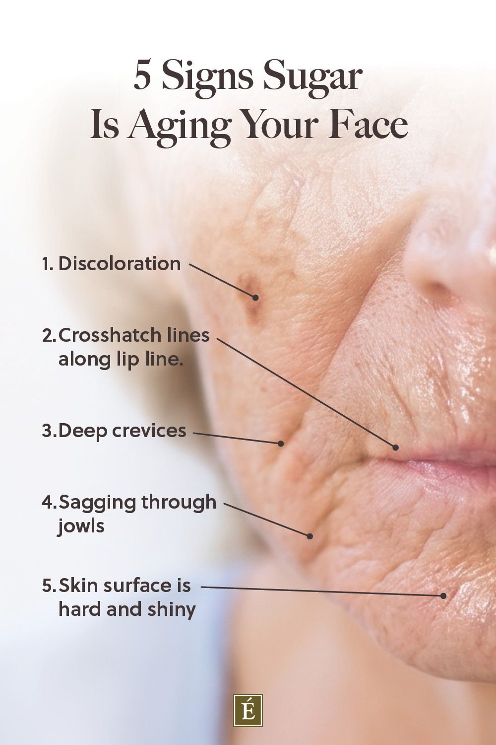 5 signs sugar is aging your face