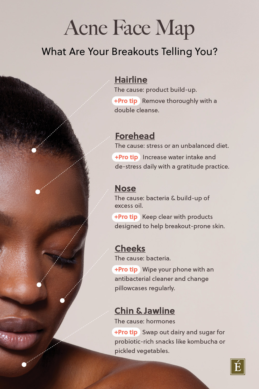 acne face map