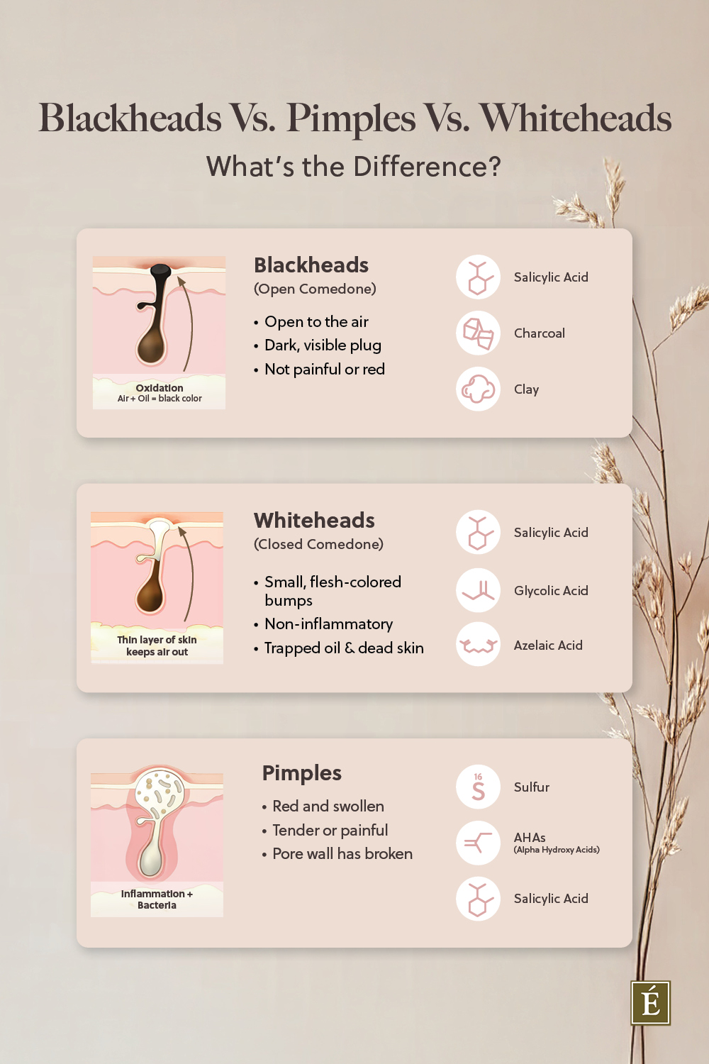 blackheads whiteheads infographic