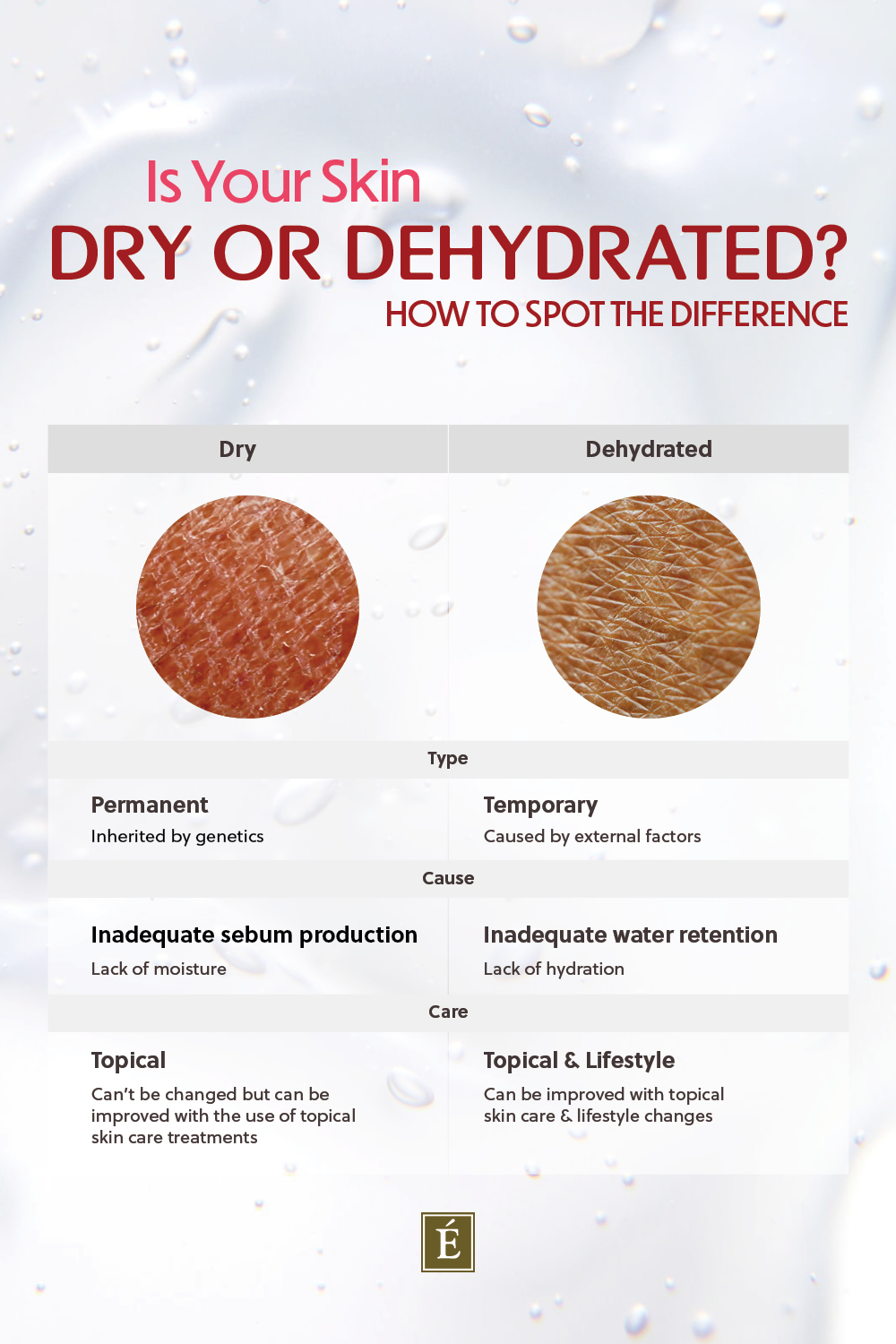 dehydrated or dry skin infographic
