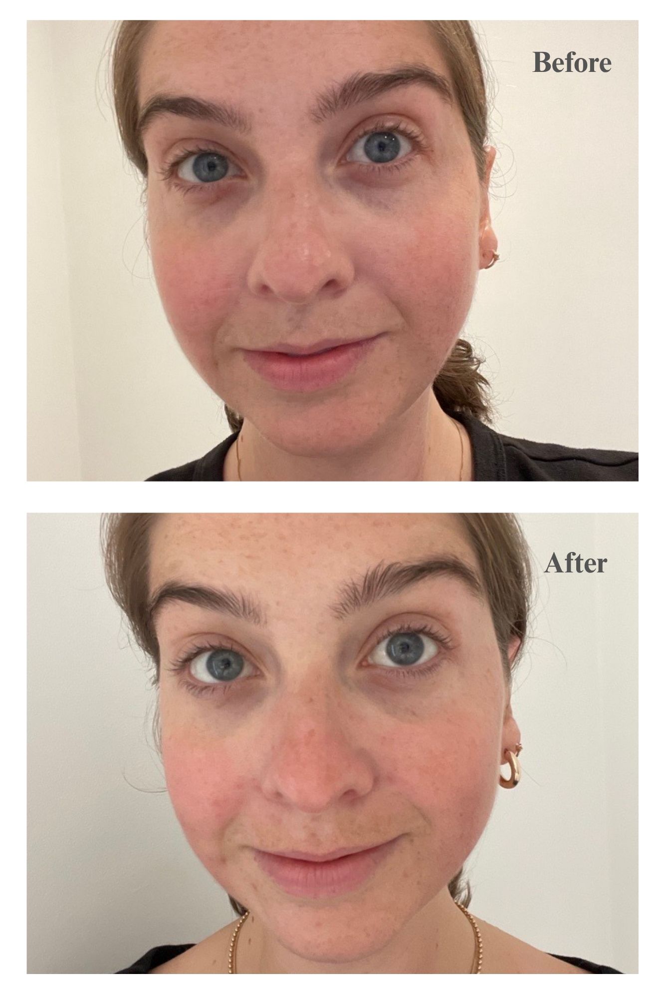 Heather closeup of before and after