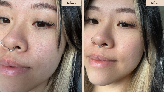 Close up of woman's face showing before & after