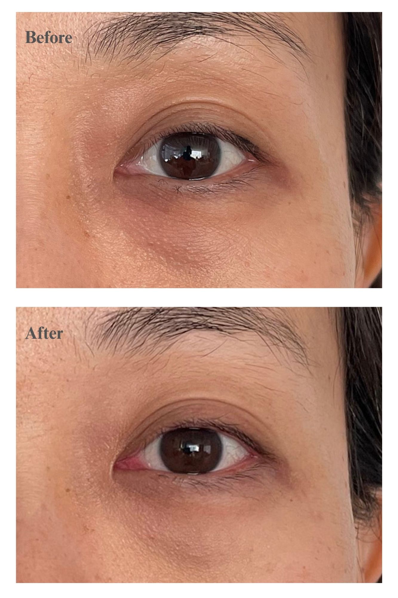 Closeup of Choo's eyes before and after