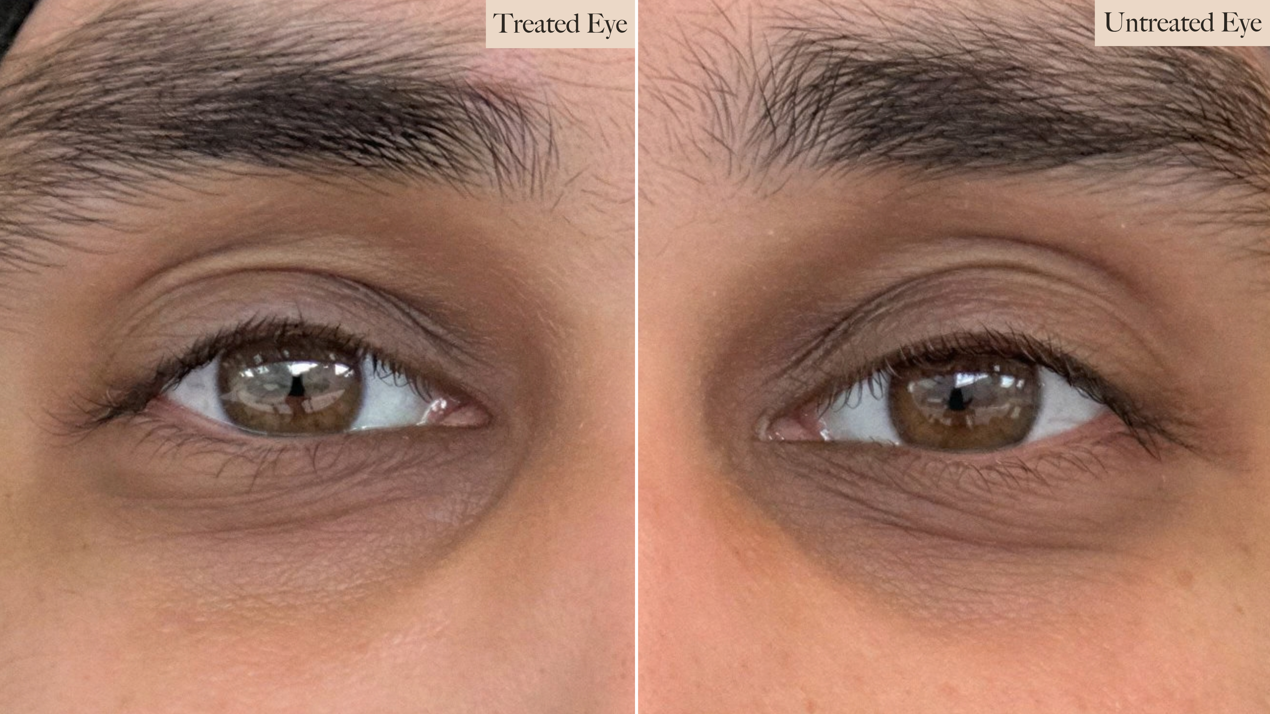 eye cream review