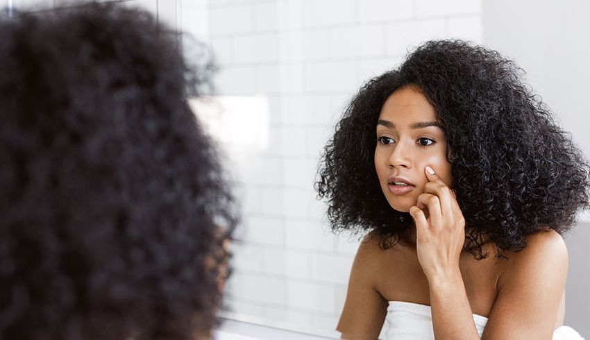 Types Of Acne: The Differences Between Your Bumps And Blemishes