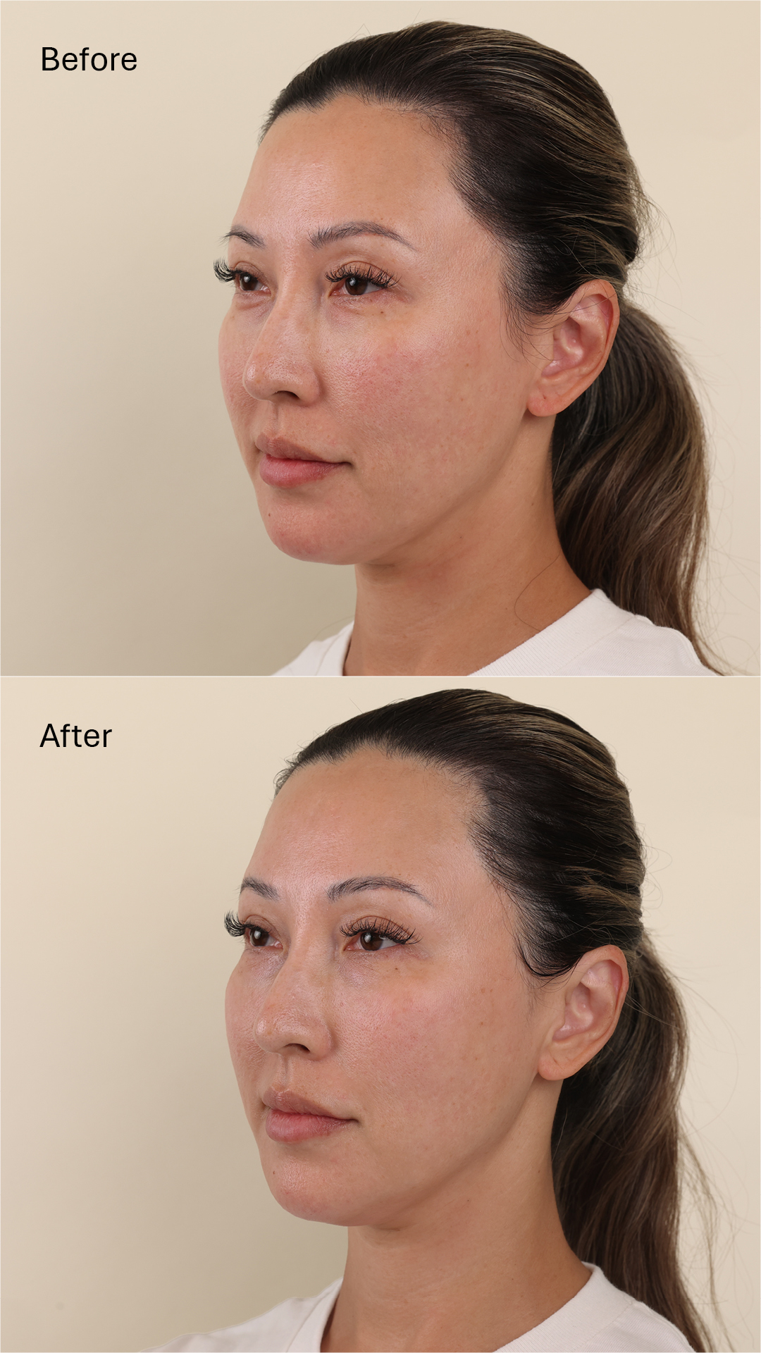 Eminence Organics Tetrapeptide Lifting Gel Before And After