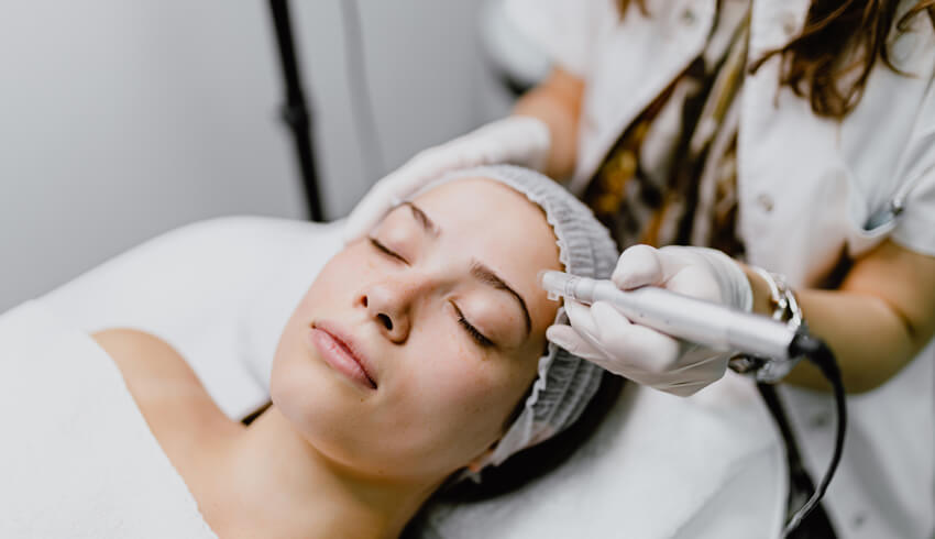 A woman lies on a facial bed as another women performs microneedling on her face. 