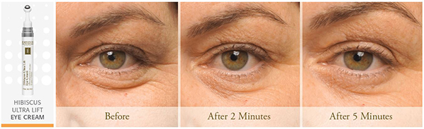 Before and after results using Eminence Organics Hibiscus Ultra Lift Eye Cream