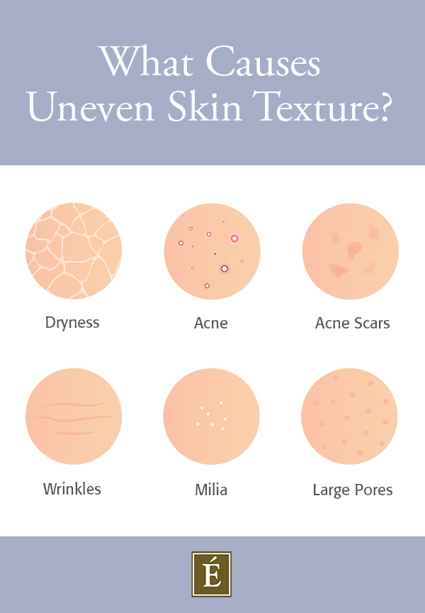 uneven skin texture causes infographic