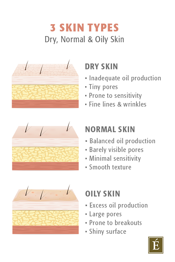 skin types infographic