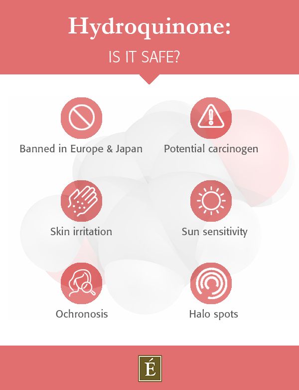 Infographic asking: Is hydroquinone safe? 