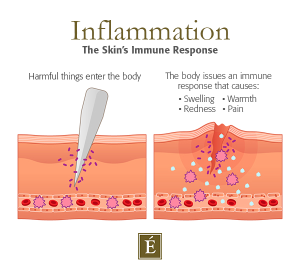 skin inflammation cross section