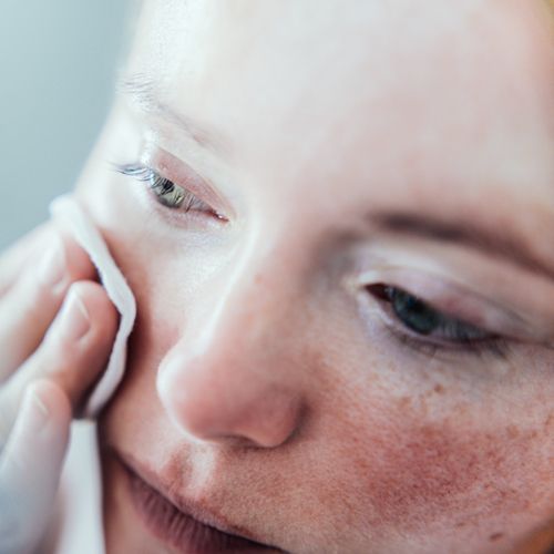 Closeup of woman with sensitive skin cleansing face