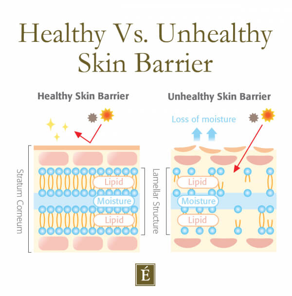 Healthy vs unhealthy skin barrier