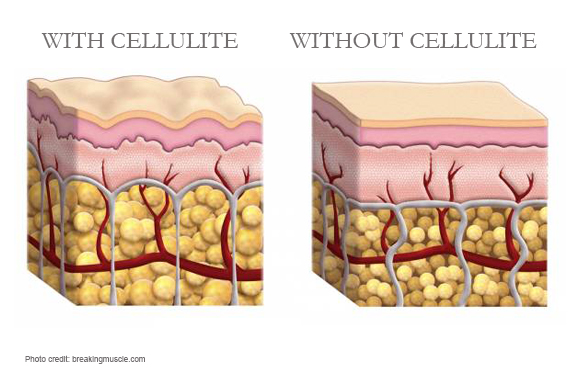 Reduce The Look of Cellulite in 5 Ways | Eminence Organic Skin Care