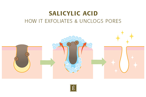 How salicylic acid exfoliates and unclogs pores