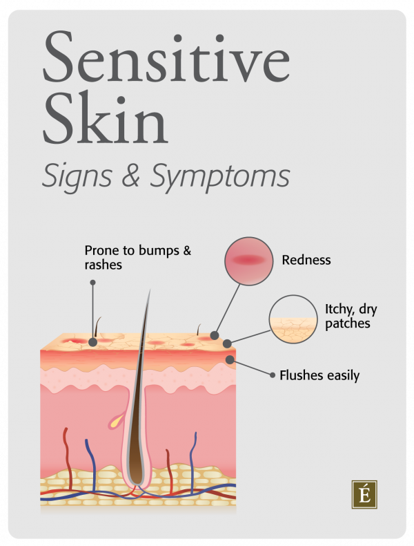 grus Vågn op Demontere Sensitive Skin Care: The Signs & Symptoms | Eminence Organic Skin Care