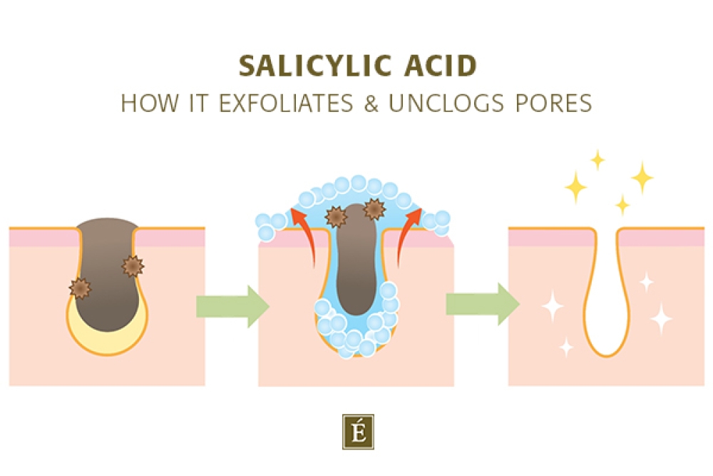 How salicylic acid exfoliates and its effects Unclogs pores