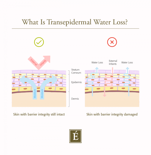 What is Transepidermal Water Loss?