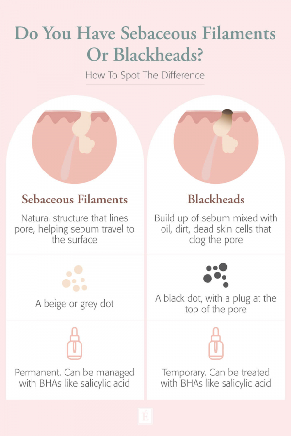 Infographic: Do You Have Sebaceous Filaments Or Blackheads